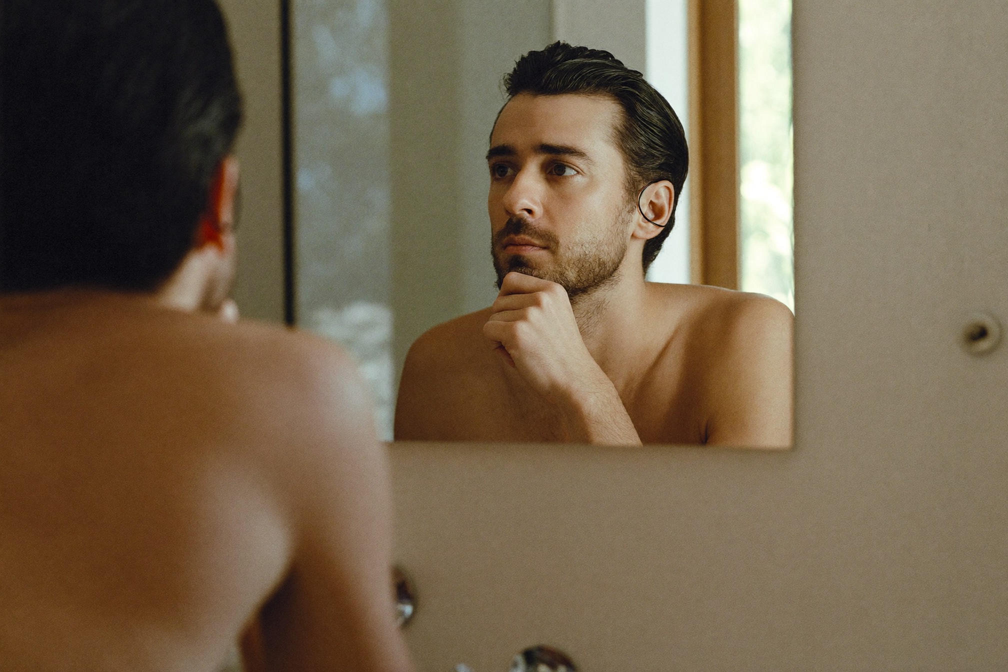 Can TRT Cause Hair Loss?