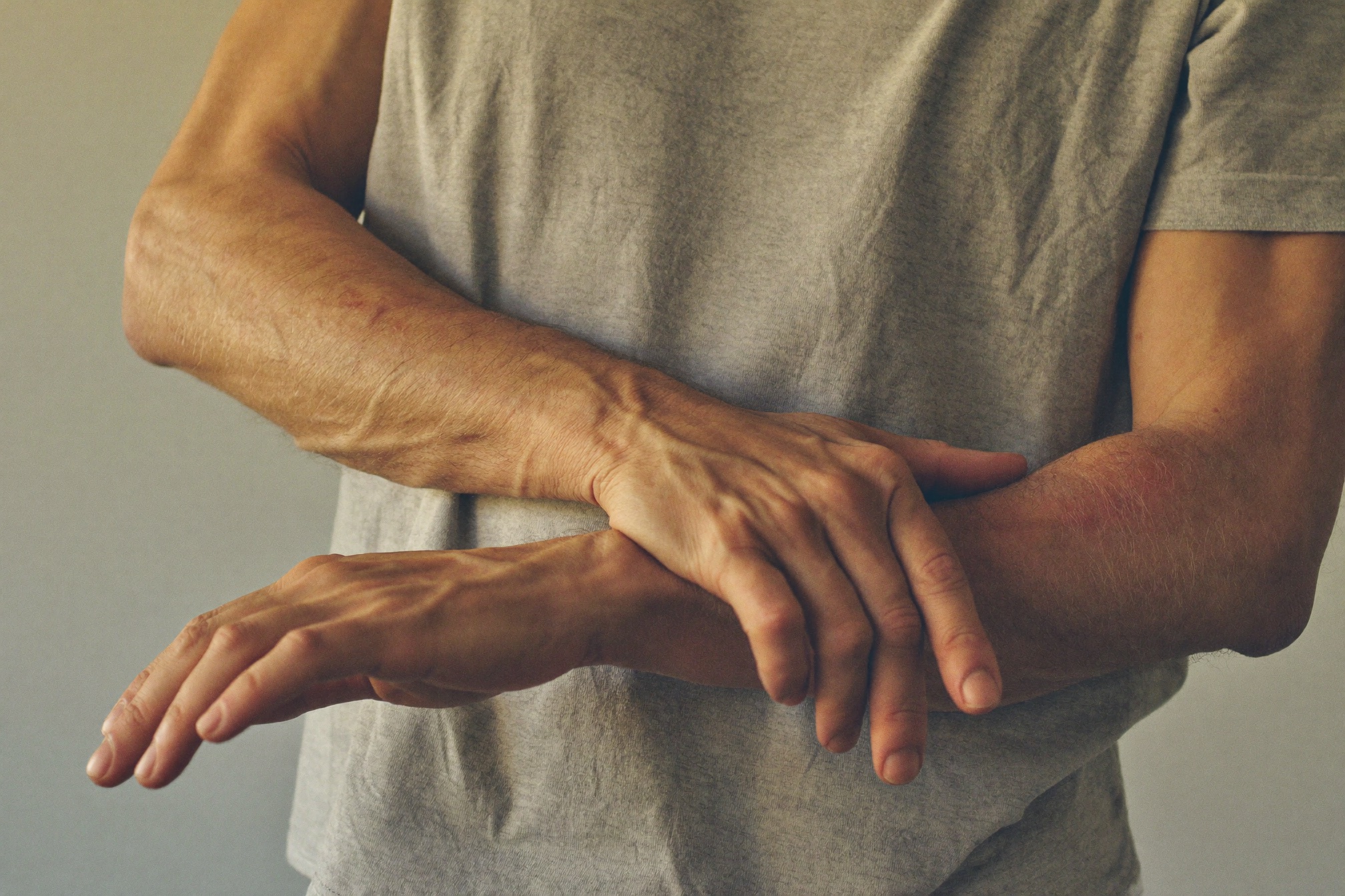 Does TRT Increase Your Risk of Bone Fractures?